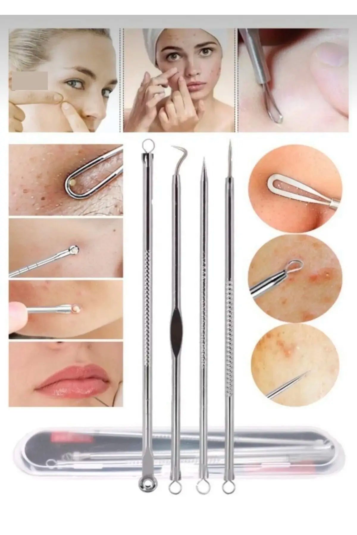 KIT REMOVEDOR EXTRACTOR PUNTOS NEGROS ESPINILLAS ACNÉ 4 PIEZAS FULL