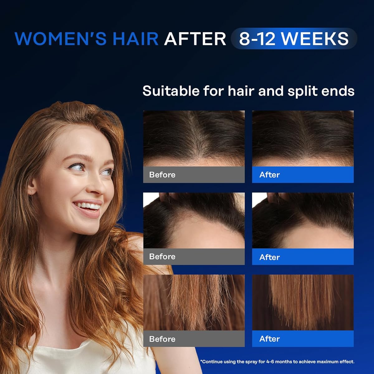 Suero para el Crecimiento del Cabello con 5% Minoxidil y Biotina – Unisex