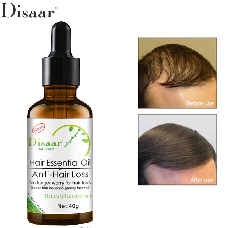 Tratamiento Anticaída del Cabello DISAAR Aceite Esencial 30g