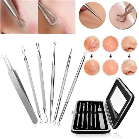 KIT REMOVEDOR EXTRACTOR PUNTOS NEGROS ESPINILLAS ACNÉ 4 PIEZAS FULL