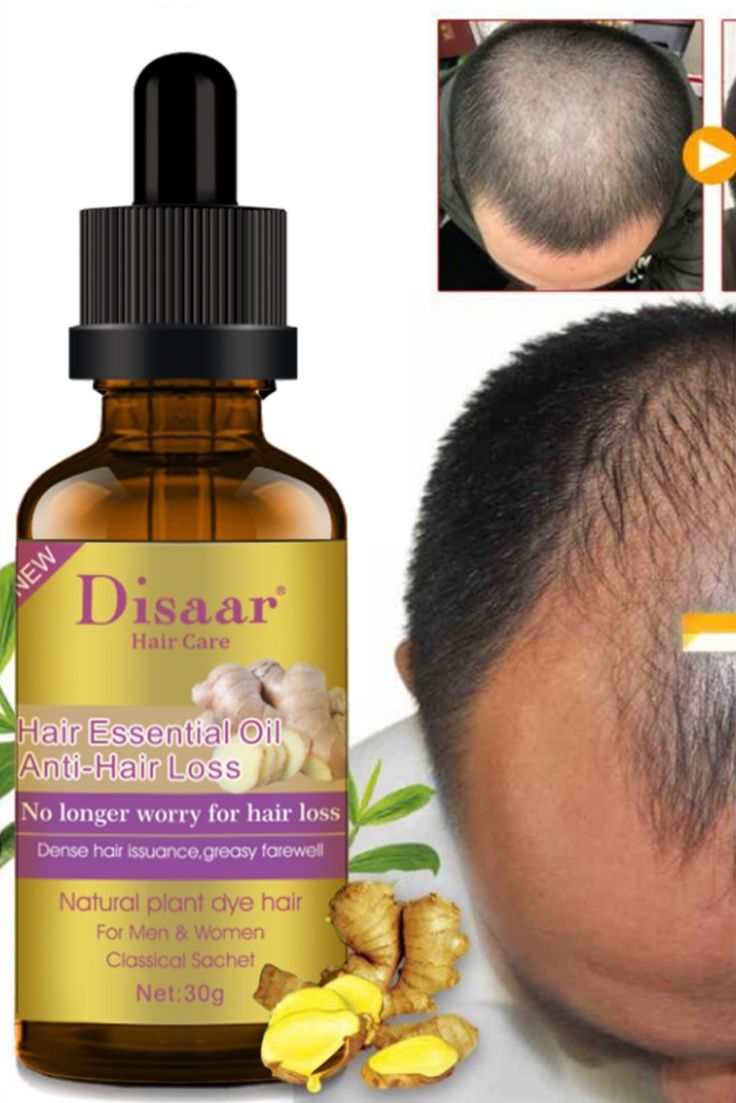 Tratamiento Anticaída del Cabello DISAAR Aceite Esencial 30g