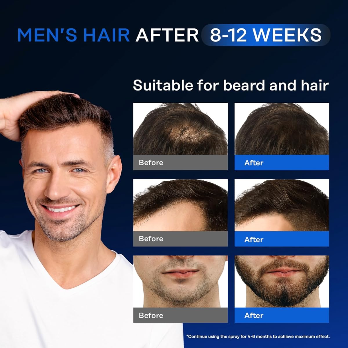 Suero para el Crecimiento del Cabello con 5% Minoxidil y Biotina – Unisex