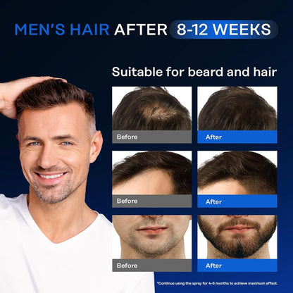Suero para el Crecimiento del Cabello con 5% Minoxidil y Biotina – Unisex