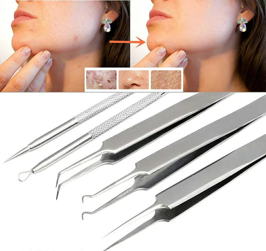 KIT REMOVEDOR EXTRACTOR PUNTOS NEGROS ESPINILLAS ACNÉ 4 PIEZAS FULL