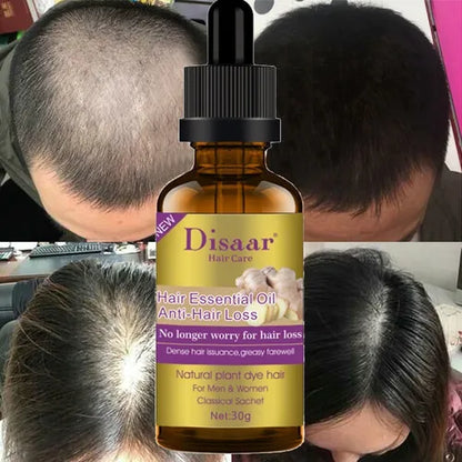 Tratamiento Anticaída del Cabello DISAAR Aceite Esencial 30g