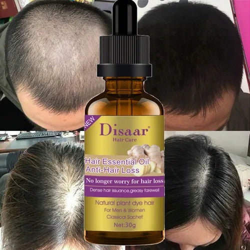 Tratamiento Anticaída del Cabello DISAAR Aceite Esencial 30g