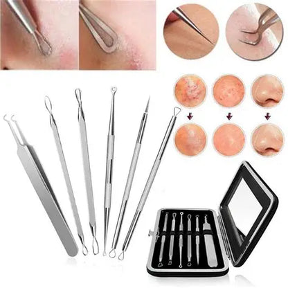 KIT REMOVEDOR EXTRACTOR PUNTOS NEGROS ESPINILLAS ACNÉ 4 PIEZAS FULL